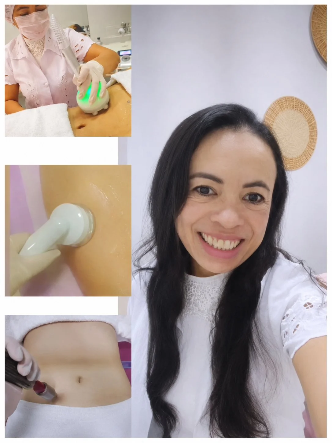 Enfermeira Jany Moreira realizando procedimentos corporais na Estética Lótus Foz